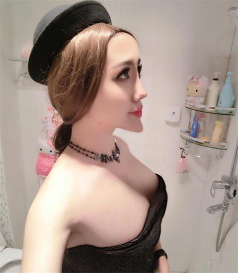 又見(jiàn)整容奇葩 蛇精男成蛇精女