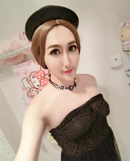 又見(jiàn)整容奇葩 蛇精男成蛇精女