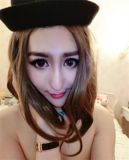又見(jiàn)整容奇葩 蛇精男成蛇精女