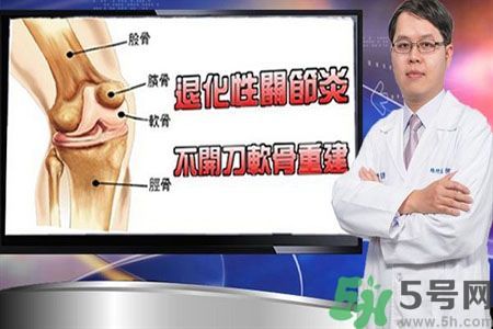膝蓋痛怎么辦？膝蓋痛如何治療好？