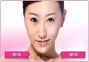 美白針真的有效嗎？美白針的危害有哪些？