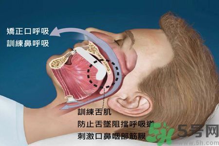 耳鳴是什么原因引起的？耳鳴怎么治療最好？