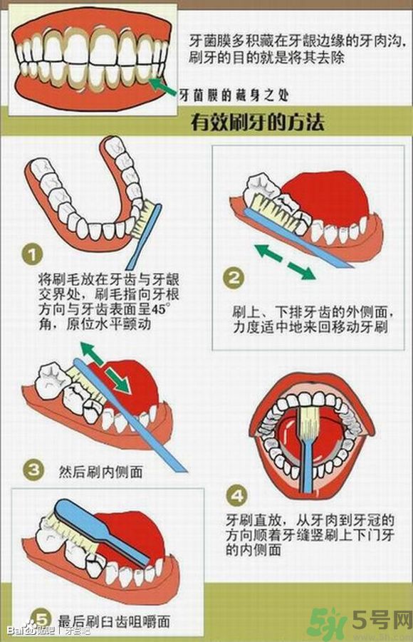 18歲還能戴牙套嗎？戴牙套真的能瘦臉改變臉型嗎？