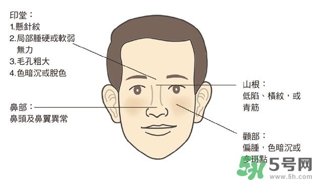 耳垂上有豎紋是怎么回事？山根有橫紋是什么?。?></p><h3>唇舌</h3><p>我們吃進食物的營養(yǎng)物質透過脾胃消化吸收後，一部分成為制造血液的來源，轉換成血液後，再由心的系統(tǒng)輸送到全身。而中醫(yī)認為「心開竅於舌」、「脾開竅於唇」，脾胃的消化吸收能力好不好，看嘴唇的顏色及形狀就知道，如果脾胃功能不佳，營養(yǎng)不良，那當然也會影響到一個人的心血管系統(tǒng)；而舌頭更是觀察心臟功能的顯性部位，除了靜態(tài)的觀察舌頭的形狀和顏色之外，動態(tài)的言語功能，有時也直接反映了心的狀態(tài)，例如常見的中風先兆，即會有言語遲鈍或出現(xiàn)表達障礙等。</p><p>● 唇形：（建議拿以前的照片對照最清楚）最常見到的變化是上唇變得比較薄而扁，與病人的整體唇形和面形不成比例，缺少立體感，甚至還出現(xiàn)緊繃、微微向牙齦內收的感覺，乍看像是抿嘴，其實不是。讀者可能會問：「那是因為他本來的嘴唇比較薄才會變成這樣。我是厚唇，應該不會吧！」其實不然。嘴唇變薄與原來唇形的厚薄無關，而是一種相對比例的改變，所以才要跟自己過去的照片和整體的唇形面形相比較。</p><p>●唇色：營養(yǎng)充足健康的人，唇色為鮮紅色，如果出現(xiàn)比較暗沉的顏色，或兼有瘀斑，都是瘀血的現(xiàn)象；如果唇色偏淡，就是血不足欠血。</p><p>● 舌頭：健康的舌色鮮紅，大小厚薄適中，跟人的體型成比例，體型壯碩的人舌頭較大，體型瘦弱的人舌頭較小。實證的舌頭厚厚腫腫，顏色暗紅，舌面或舌邊出現(xiàn)暗斑，中醫(yī)稱為「瘀斑」；卷起舌頭，舌下的靜脈色暗，腫起甚至彎曲，中醫(yī)稱為「絡脈怒張」，這都是氣血瘀滯的現(xiàn)象。虛證的舌頭形狀改變不大，但顏色偏淡。</p> </div>
<div align=