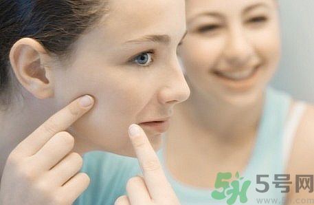 臉上有痘印怎么去除？去除痘印的小妙方？