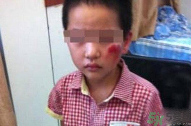 男孩遭校長暴打的結(jié)果是什么？男孩遭校長暴打的真相是什么？