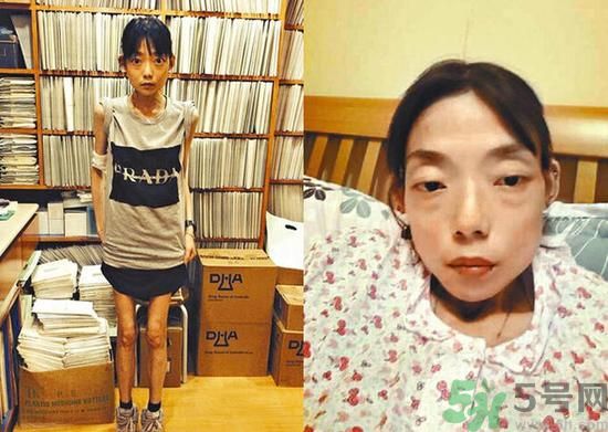 富二代離婚娶二線女星前妻瘦成骷髏  怎么選擇有責(zé)任的男人？