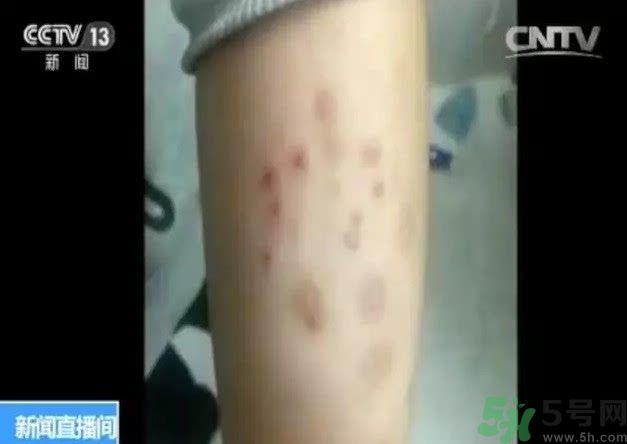 被污染學(xué)校是哪個(gè)？500師生患病的原因？
