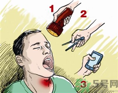 魚刺卡喉喝醋可以治療嗎？魚刺卡喉喝醋好不好？
