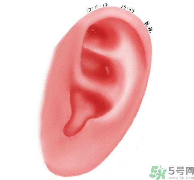 耳石脫落導(dǎo)致的眩暈怎么辦？耳石癥暈眩能自愈嗎？
