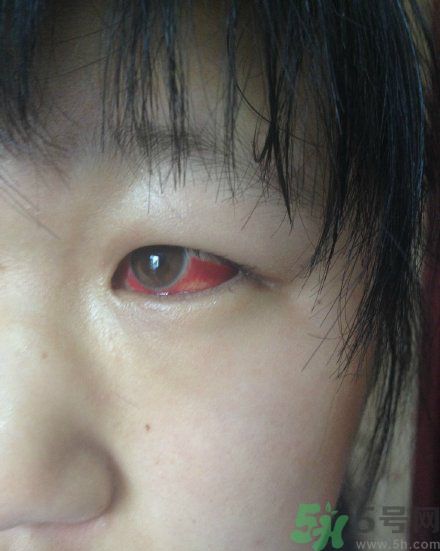 初中生全體甲醛中毒是怎么回事？初中生全體甲醛中毒是哪個(gè)學(xué)校？