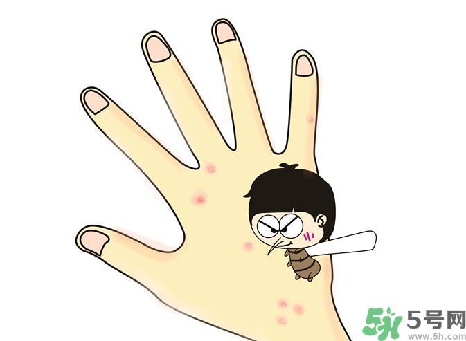 蚊子叮的包過幾天又癢是為什么？蚊子叮的包過幾天又癢怎么辦？
