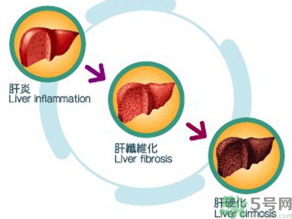在外面吃飯會得乙肝嗎？在食堂吃飯會得乙肝嗎？