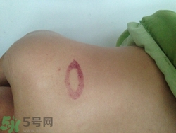 種草莓吻痕是什么意思？吻痕是怎么弄出來的？