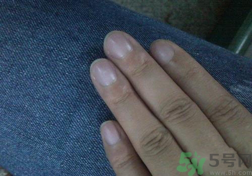 指甲發(fā)紫是什么原因？指甲發(fā)紫是怎么回事？