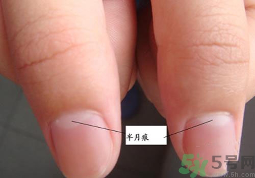 指甲沒有月牙是什么原因？指甲沒有月牙怎么調(diào)理？