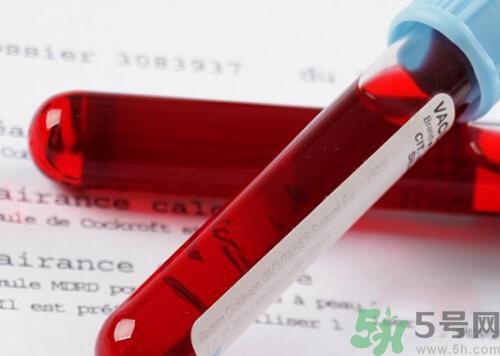 獻(xiàn)血后可以洗澡嗎？抽血后可以洗澡嗎？