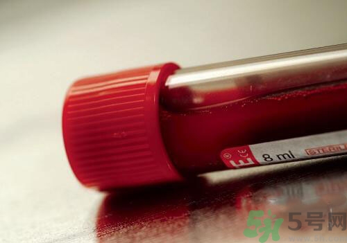 獻(xiàn)血后可以洗澡嗎？抽血后可以洗澡嗎？