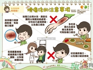 手被油燙傷了怎么處理？手被油燙起泡了怎么辦？