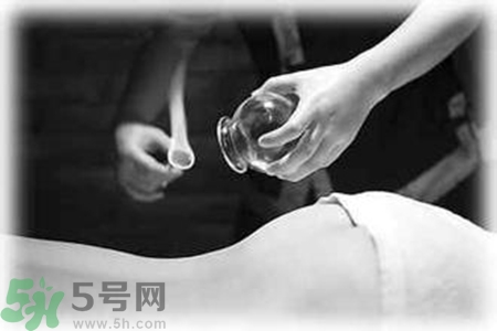 大暑可以拔罐嗎？大暑拔罐好不好？
