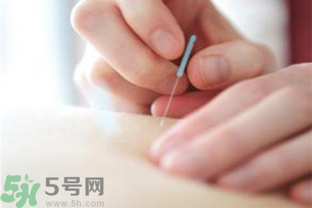 大暑可以針灸嗎？大暑針灸好不好？