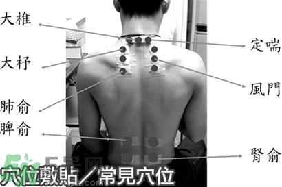 經(jīng)期可以貼三伏貼嗎？來(lái)月經(jīng)可以貼三伏貼嗎？