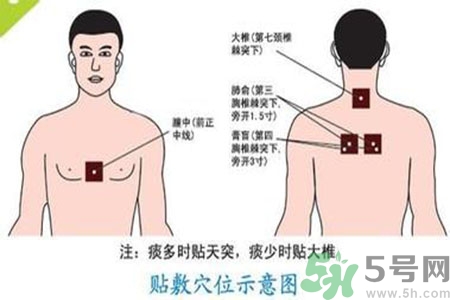 三伏貼能治頸椎病嗎？頸椎病三伏貼穴位