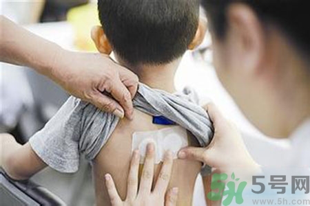 三伏貼能治頸椎病嗎？頸椎病三伏貼穴位