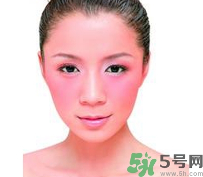 敏感性皮膚用什么洗面奶？敏感性皮膚怎么修復(fù)？