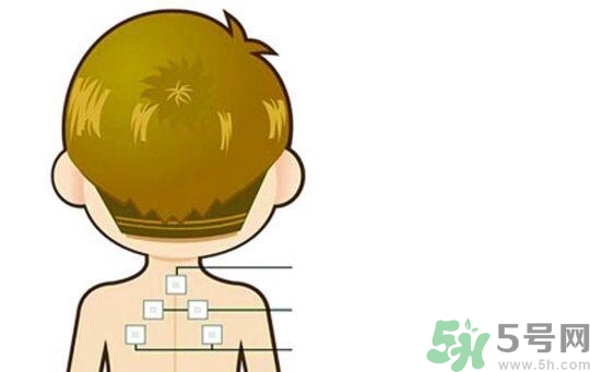 三伏貼可以去濕氣嗎？三伏貼去濕氣貼哪里？