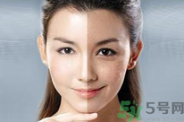 干性皮膚用什么洗面奶？干性皮膚該怎么保養(yǎng)？