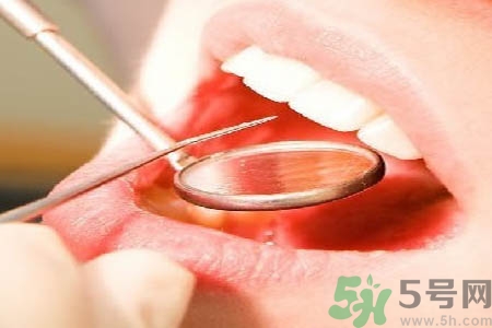 冷光美白牙齒是什么？冷光美白牙齒的好處有哪些？