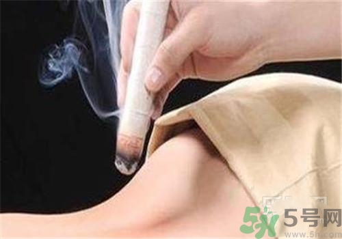 蕁麻疹可以艾灸嗎？蕁麻疹艾灸哪個(gè)穴位？