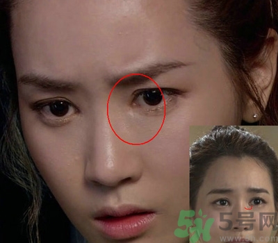 開眼角多少錢？開眼角有什么危害？