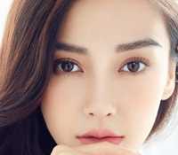 開眼角會留疤嗎？開眼角增生怎么辦？