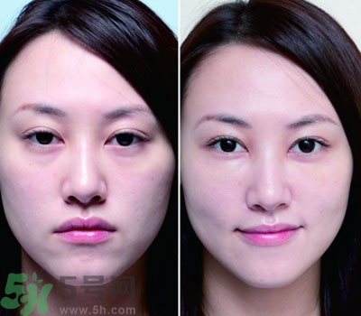 臥蠶是什么？臥蠶是眼袋嗎？