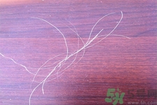 生完寶寶白頭發(fā)的原因？生完寶寶白頭發(fā)怎么辦？