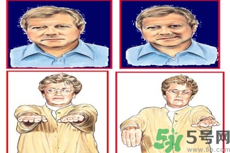 腦中風(fēng)是什么？腦中風(fēng)的癥狀？