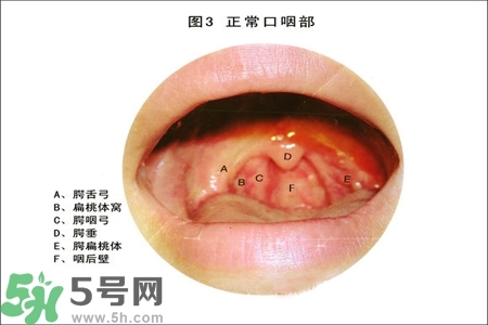 慢性咽炎的治療方法？慢性咽炎的藥物治療？