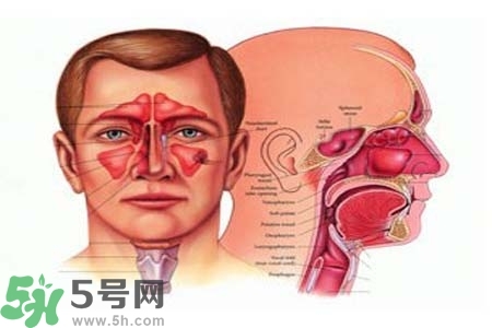 鼻竇炎的高發(fā)人群？如何預(yù)防鼻竇炎？