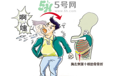 過(guò)敏性鼻炎是什么？過(guò)敏性鼻炎的癥狀有哪些？