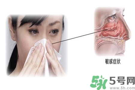 過敏性鼻炎的高發(fā)人群有哪些？如何預防過敏性鼻炎？