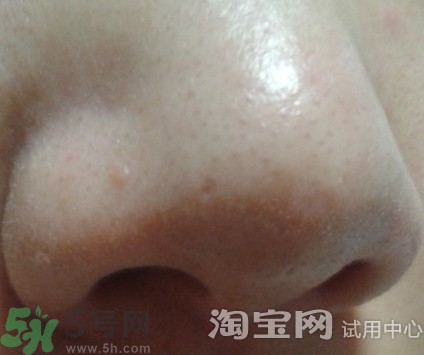 holika豬鼻貼多少錢?holika豬鼻貼韓國價(jià)格