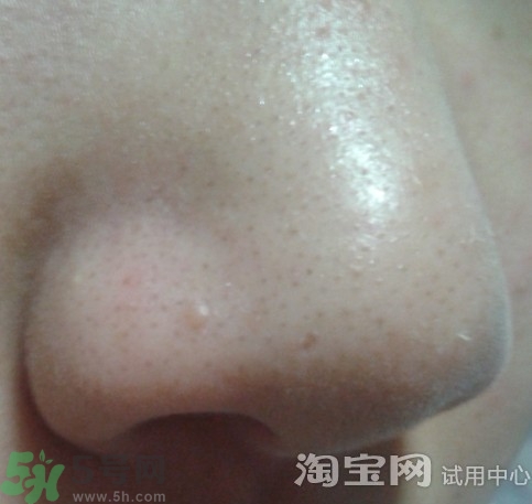 holika豬鼻貼多少錢?holika豬鼻貼韓國價(jià)格