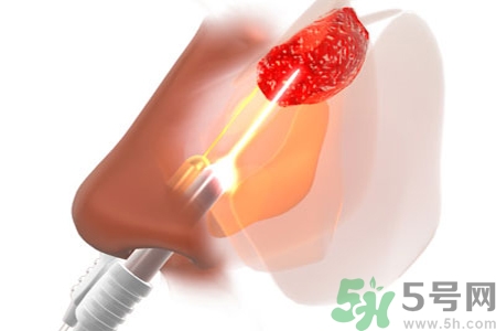 鼻咽癌的日常措施是什么？鼻咽癌注意的飲食有哪些？