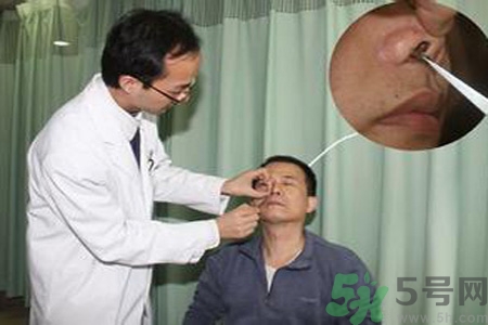 鼻咽癌的治療方法是什么？鼻咽癌可以用什么藥物治療？