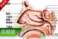 鼻咽癌的發(fā)病因素是什么？鼻咽癌的并發(fā)癥有哪些？
