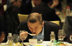 男人禿頂會遺傳嗎？男人禿頂是腎虛嗎？