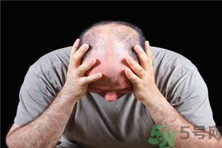 脫發(fā)的高發(fā)人群有哪些？如何預防脫發(fā)？