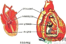 先天性心臟病可以用藥物治療嗎？